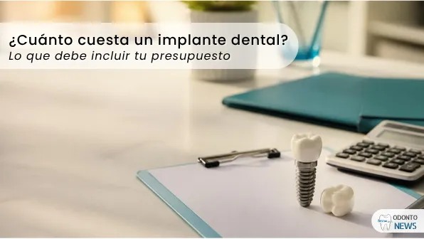Portada: costo de un implante dental