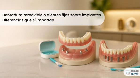 Portada: dentadura removible o dientes fijos