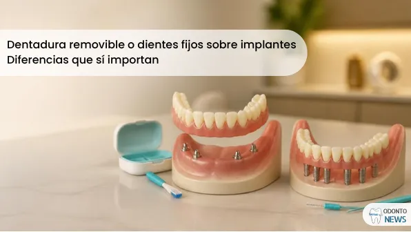 Portada: dentadura removible o dientes fijos