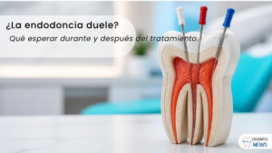 Portada: dolor de endodoncia