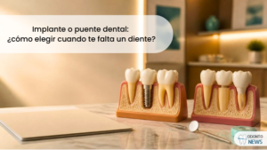 Portada: implante o puente dental