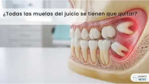 Portada: muelas del juicio