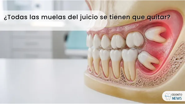 Portada: muelas del juicio