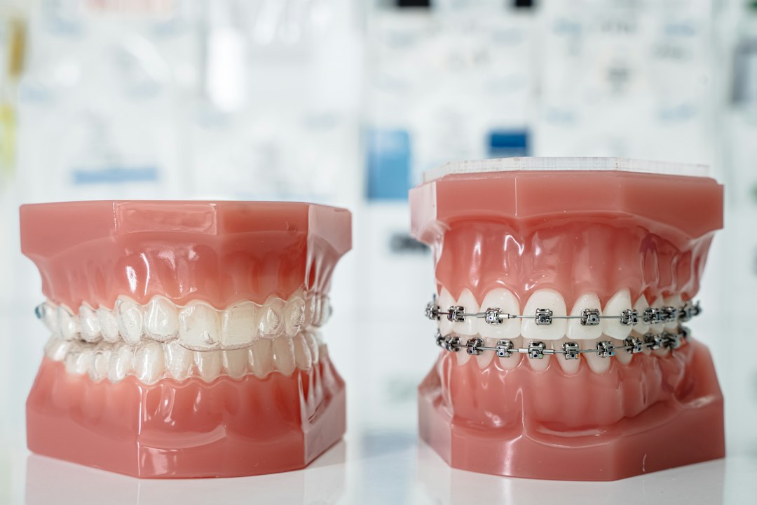 Two dental models side by side: one with clear aligners and one with metal braces