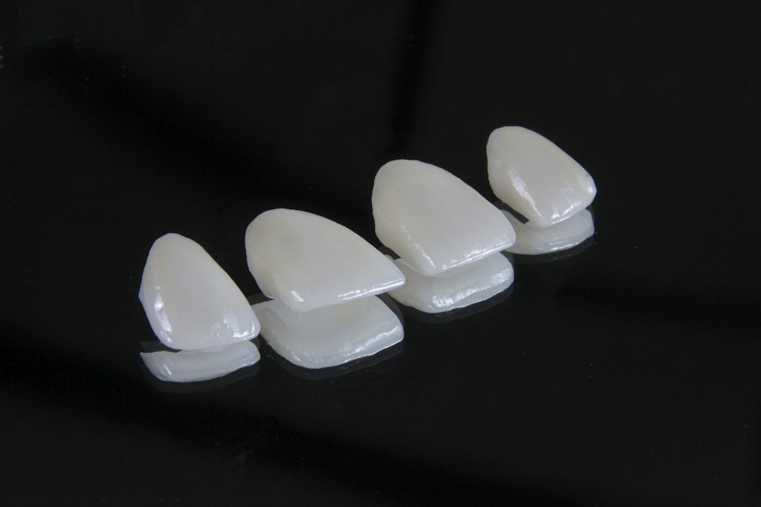 Four porcelain dental veneers on a black background