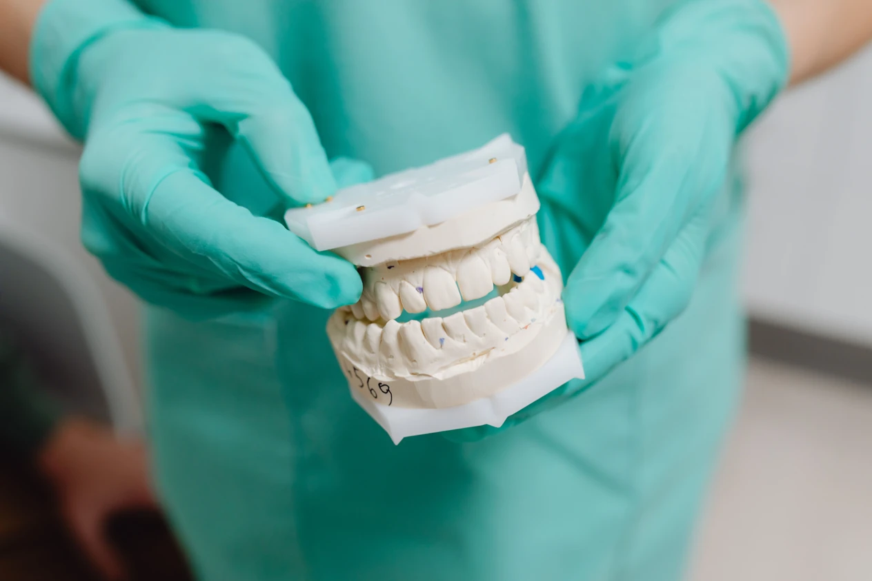 Green-gloved hands holding a plaster model of the upper and lower dental arches.